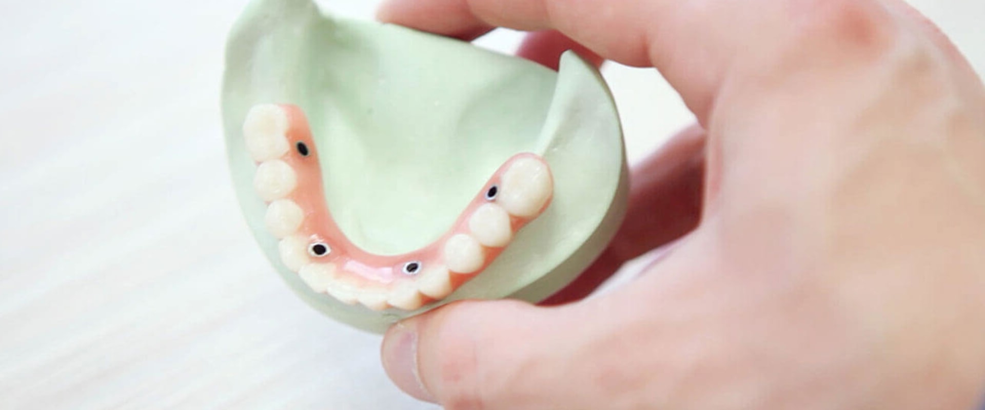 Increased stability and chewing ability: The Benefits of Implant Supported Dentures