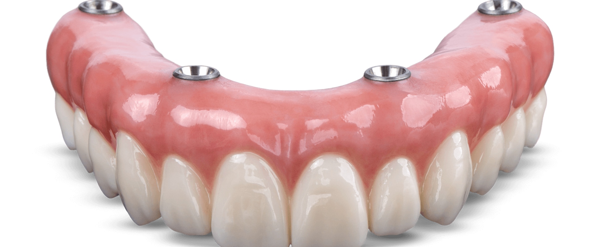 Top Brands for Implant Supported Dentures