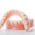 Understanding the Quality Differences Between Brands of Implant-Supported Dentures