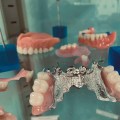 Choosing the Right Type of Denture for You