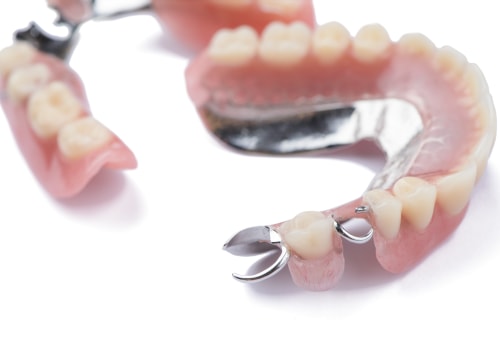 Understanding the Differences Between Full and Partial Dentures
