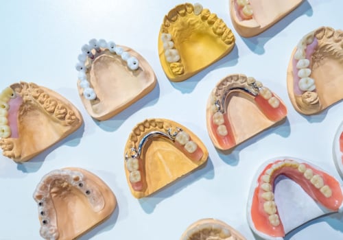 How to Properly Clean and Care for Different Types of Dentures